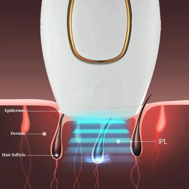 Depilador à Laser Permanente Luz Pulsada - LaserPro